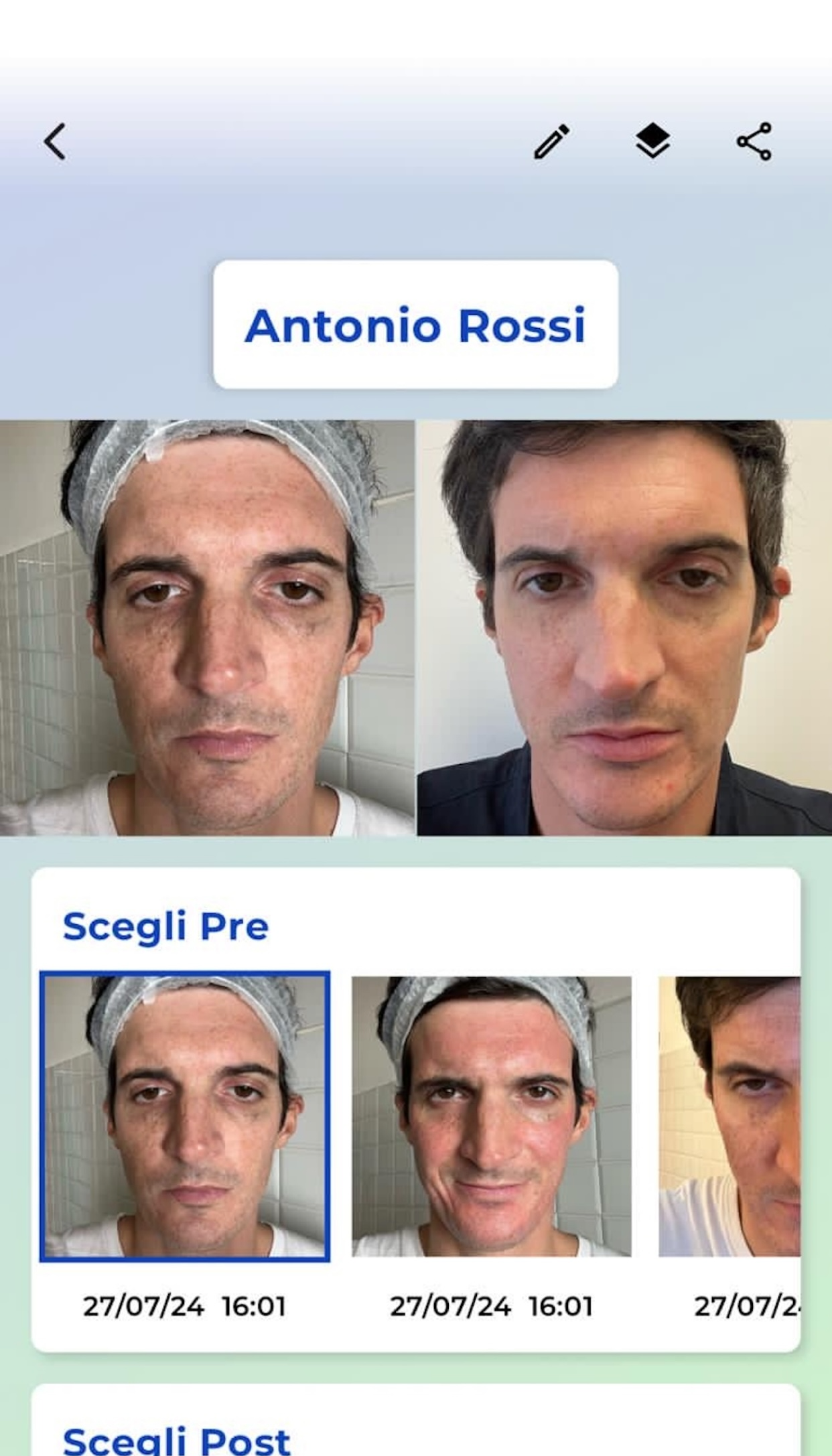 Screenshot dell'app piCompare per il confronto immagini prima e dopo, disponibile su App Store